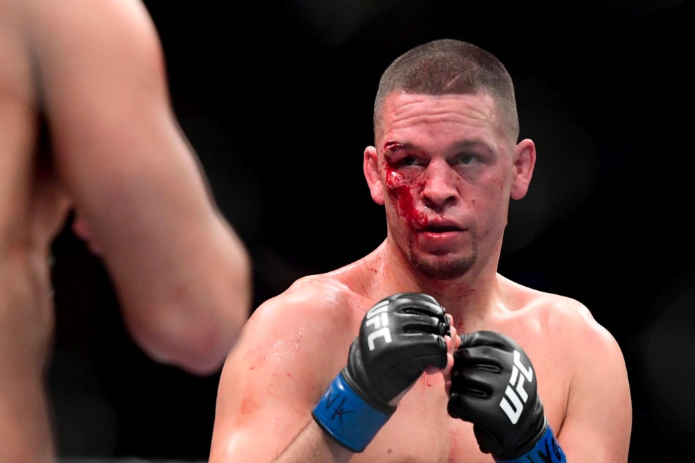 Cuộc chiến giữa Nate Diaz và Leon Edwards được dời sang UFC 263 nhưng vẫn giữ số hiệp đấu là 5.