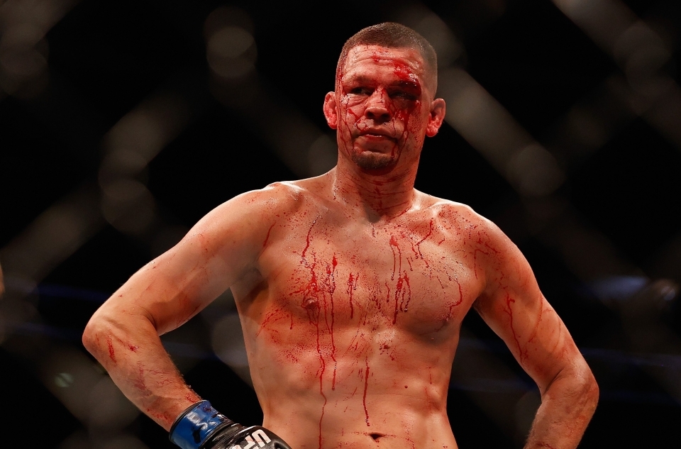 Nate Diaz vẫn chưa thể chốt lịch trở lại lồng bát giác.