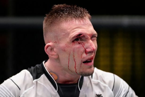 Vết cắt gần mắt khiến Evan Elder bị xử thua TKO.